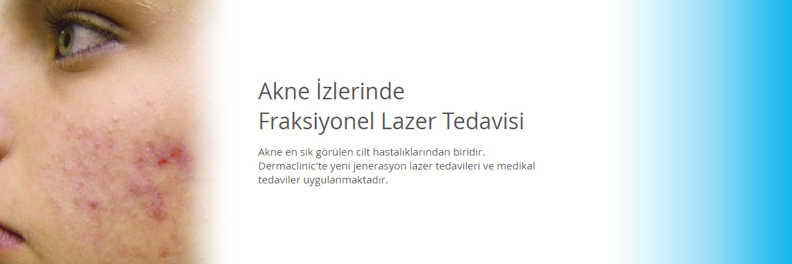 Dermaclinic Poliklinik - Dermatolog Uzm. Doktor Fatma ÖZEL - Bursa